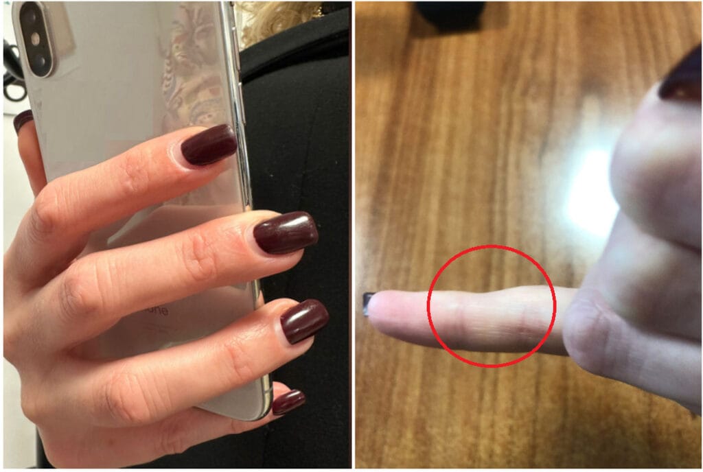 Smartphone e postura: i rischi per le tue mani