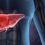 La minaccia silenziosa del fegato che pochi conoscono.