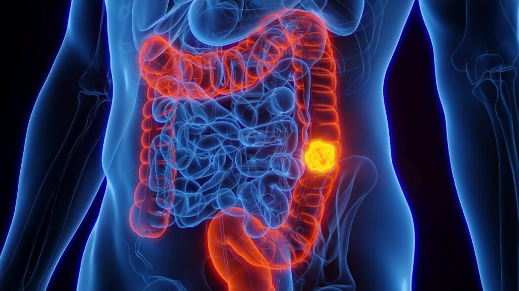 Italia: Scopri i 3 Segreti che Salvano dall'Intestino