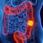 Italia: Scopri i 3 Segreti che Salvano dall'Intestino